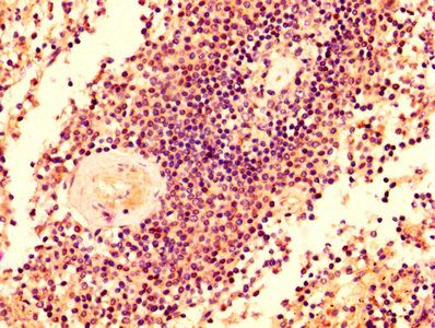 GRK2 Antibody