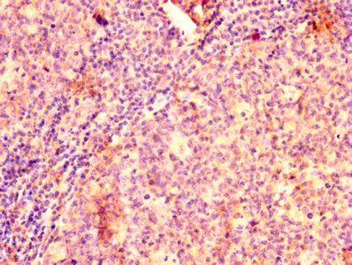 GRK2 Antibody