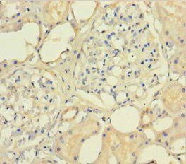 SMARCB1 Antibody