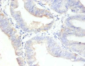 gen KI-67 antibody