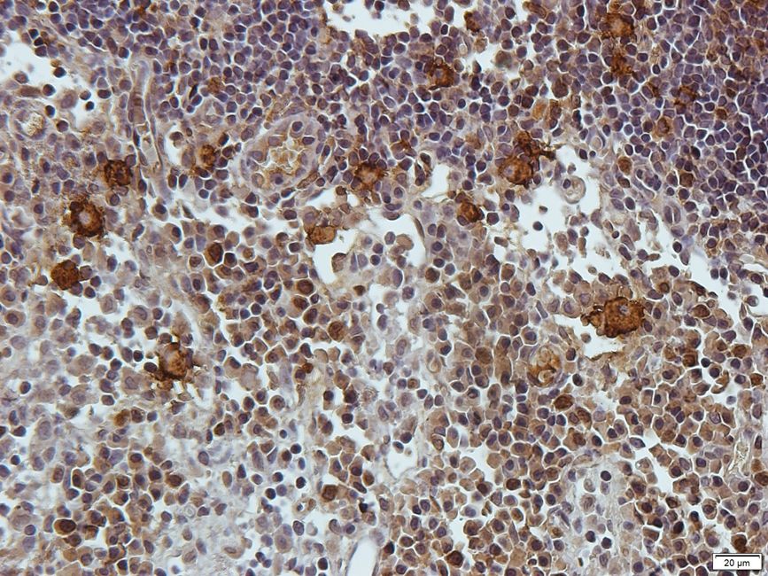 Antigen KI-67 antibody