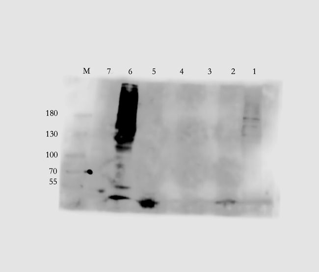 Antigen KI-67 antibody