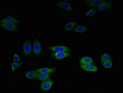 leukoproteinase antibody