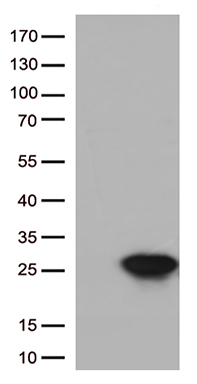 Antizyme inhibitor 1 (AZIN1) Mouse Monoclonal Antibody [Clone ID: OTI3C3]