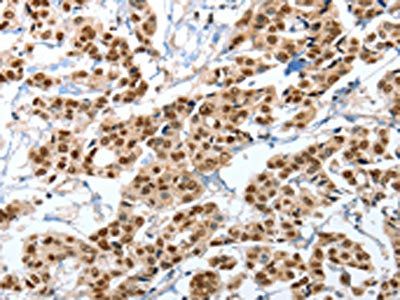 ANXA10 Antibody
