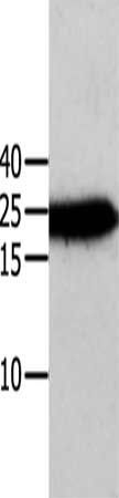 ANXA5 Antibody