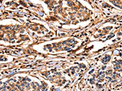 ANXA6 Antibody