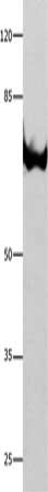 ANXA6 Antibody
