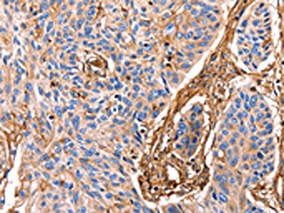 ANXA6 antibody