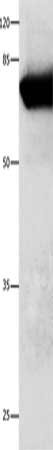 ANXA6 Antibody