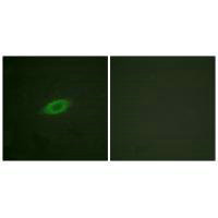 ANXA6 Antibody