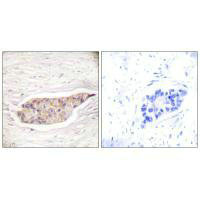 ANXA6 Antibody