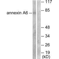 ANXA6 antibody