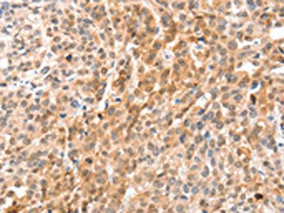 ANXA8 antibody