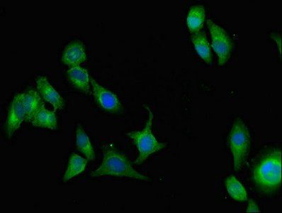 AOC3 antibody