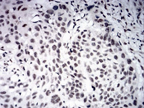 AOF1 Antibody