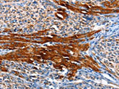 AOX1 Antibody