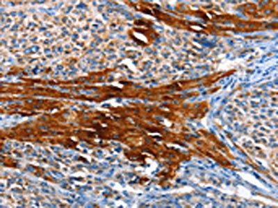 AOX1 antibody