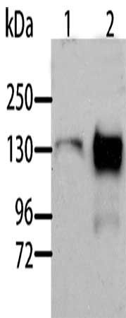 AOX1 antibody