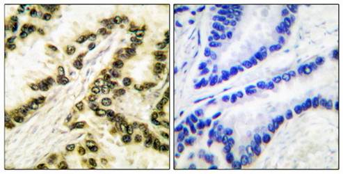 AP-2 Antibody