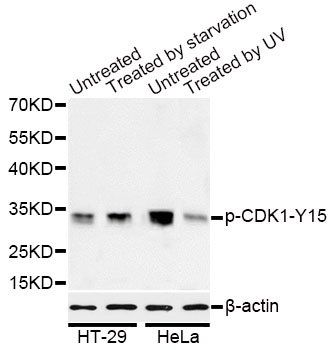 CDK1 (phospho-Y15) antibody