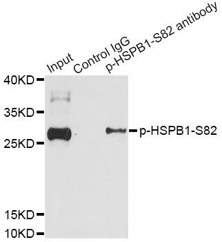 HSPB1 (phospho-S82) antibody