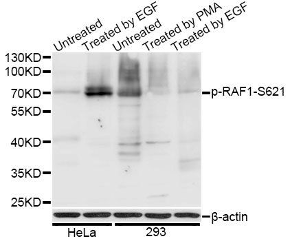 RAF1 (phospho-Ser621) antibody