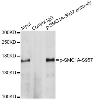 SMC1A (phospho-S957) antibody
