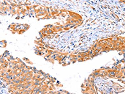 AP1B1 Antibody