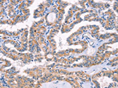 AP1B1 antibody