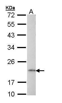 adaptor related protein complex 1 subunit sigma 2 Antibody