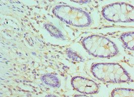 AP2M1 Antibody