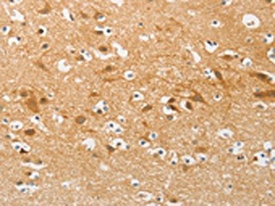 AP2M1 Antibody
