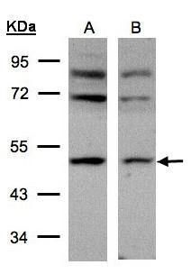 adaptor related protein complex 2 subunit mu 1 Antibody