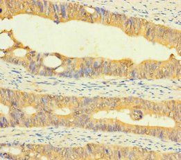 AP3M2 Antibody