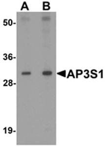 AP3S1 Rabbit Polyclonal Antibody