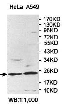 AP3S1 Rabbit Polyclonal Antibody