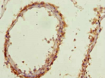 AP4B1 Antibody