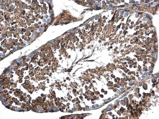 AP4M1 antibody [N1C1]