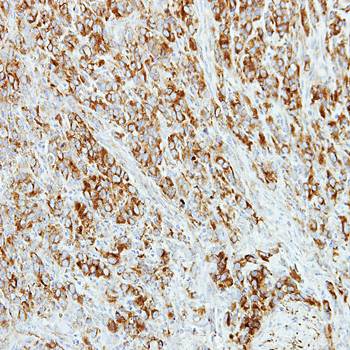 AP4M1 antibody