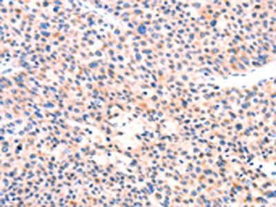 APBA2 Antibody