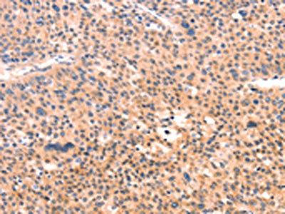APBA2 Antibody