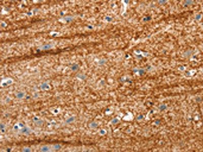 APC Antibody