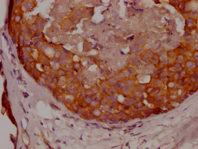 APC Recombinant Monoclonal Antibody