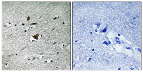 APC1 (Ab-355) Antibody
