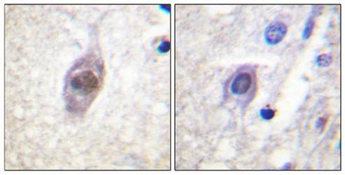 APC (Ab-2054) Antibody