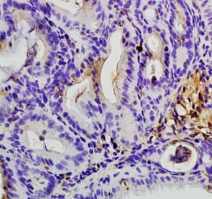 APC Rabbit Polyclonal Antibody