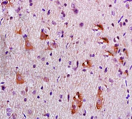 APC Rabbit Polyclonal Antibody