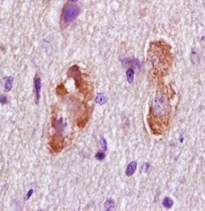 APC Rabbit Polyclonal Antibody