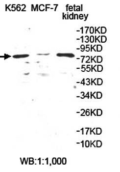 APEH Rabbit Polyclonal Antibody